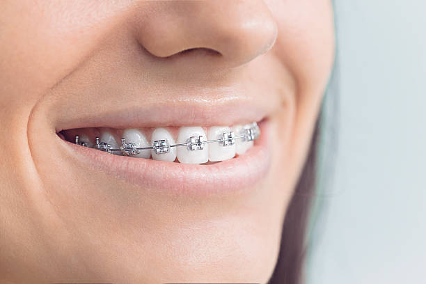 Best Wisdom Tooth Removal  in Airport, CA
